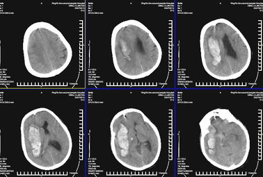 Good price Représentation diagnostique médicale imperméable KND-K de X Ray pour l'imprimante à laser de Konida en ligne