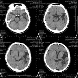 Good price imagerie médicale Éraflure-résistante de X Ray pour l'imprimante à laser de Konida en ligne