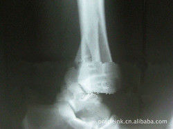 Imagerie médicale 8in x 10in du laser X Ray de livre blanc imperméable