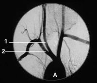 Good price Films médicaux de X Ray de Konida en ligne
