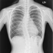 Good price Pouce X12 sec médical bas blanc du film 10 du laser X Ray dégradable en ligne