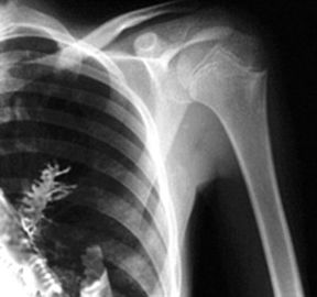 Good price Film radiographique médical d'Agfa/Fuji, film portatif d'imprimante à laser de radiographie en ligne
