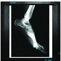 représentation diagnostique médicale de 20cm x de 25cm, papier du film X Ray d'imprimante à laser