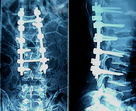 AGFA bleu X Ray médical filme 10in x 12in, acuité élevée