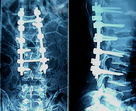 Good price Films médicaux de X Ray d'acuité élevée en ligne