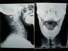 Good price Film à haute densité X Ray d'imagerie médicale sec pour Fuji 3000/2000/1000 en ligne