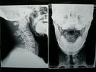 X film d'imagerie médicale de Ray