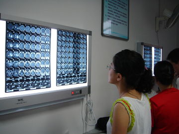 Film sec médical sec 10in x 12in de X Ray de laser pour des imprimantes de Fuji