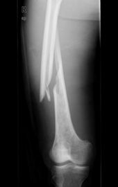 Imagerie médicale du laser X Ray de Konida