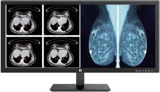 Bon prix Affichage médical haute définition avec conformité DICOM pour l'imagerie de qualité radiologique en ligne