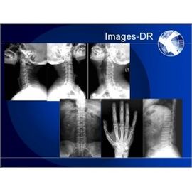 Système portatif de radiographie de DR Digital, système de RAYON X de Mammogrpahy