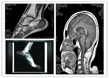 Good price Film sec bas bleu médical de représentation de Digital balayage compatible de 8 x de 10in Hosipital Mri en ligne