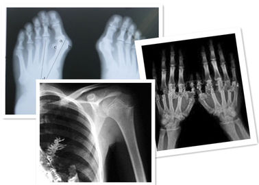 Good price Film thermique Fuji de X Ray de Digital médical pour l'examen de radiographie en ligne