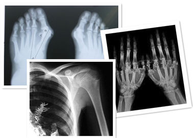 Film thermique Fuji de X Ray de Digital médical pour l'examen de radiographie