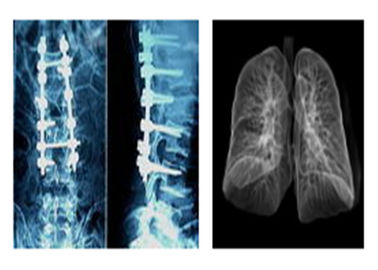 Films médicaux radiographiques pointus de X Ray, film de Dr. Ct Digital Dry Imaging de Mri