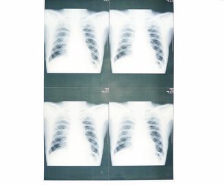 Film médical bas blanc de papier de X Ray étanche à l'humidité pour l'imprimante à laser de Sony/EPSON