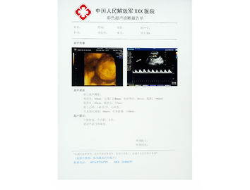 film médical de papier Éraflure-résistant de rayon X pour KND-DRYTEC-3000, KND-DRYTEC-4000