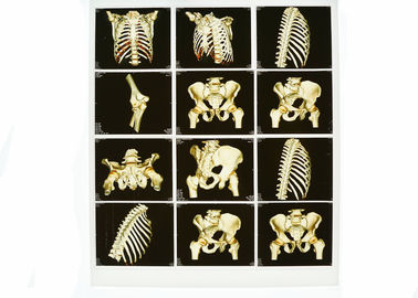 Représentation diagnostique blanche portable de la base X Ray, film bleu médical de X Ray de laser