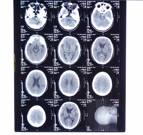 films secs d'imagerie médicale de rayon X de 10in * de 14in Digital pour les imprimantes thermiques KND-F