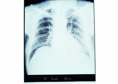 Représentation diagnostique médicale d'acuité élevée, film sec d'AGFA X Ray