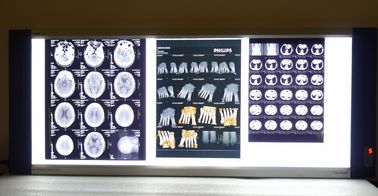 Good price Base sèche médicale lumineuse de bleu de laser de film d'imprimante thermique de X Ray en ligne