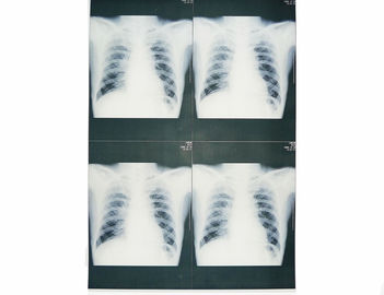 Films médicaux bas blancs portables de X Ray, film de papier de rayon X d'imagerie médicale