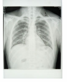 Good price Le film radiographique médical d'imprimante à laser De Konida CE de 11in x de 14in KND-K a approuvé en ligne