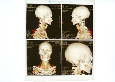 Good price Bleu médical à haute densité de film de X Ray pour l'imprimante à laser de Konida en ligne