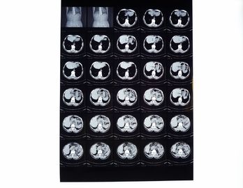 Good price Films médicaux de rayon de X, film sec de représentation compatible avec l'imprimante thermique pour le CT/DR/IRM en ligne