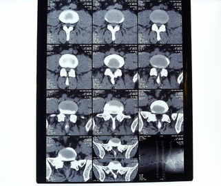 Good price 8in* 10in film sec d'imprimante thermique de rayon X médical à haute densité de 14in * de 17in en ligne