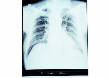 Good price Radiologie diagnostique médicale sèche de représentation de X Ray pour AGFA/FUJI 2000 en ligne