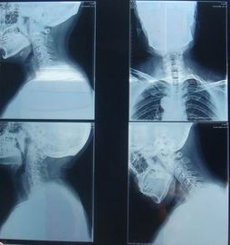Good price Film sec de papier médical Éraflure-résistant de représentation de KND-K pour l'examen radiographique en ligne