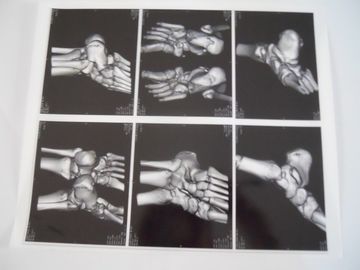 Good price Film sec médical de représentation pour l'examen de X Ray sur AGFA 5300, 5302, 5500 en ligne