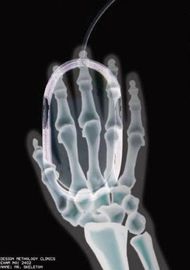 Film sec d'imagerie médicale de transparent, film thermique de X Ray d'Agfa Digital
