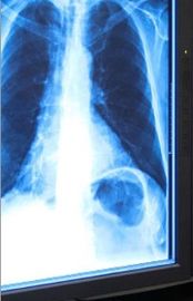 Film sec médical bleu de représentation, film de laser Fuji X Ray de 11in x de 14in
